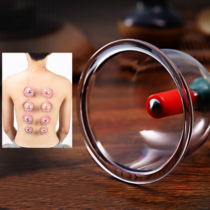 🩺 Portable Cupping Therapy Set – Manual Vacuum Cups for Home Muscle Care