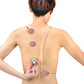 🩺 Portable Cupping Therapy Set – Manual Vacuum Cups for Home Muscle Care